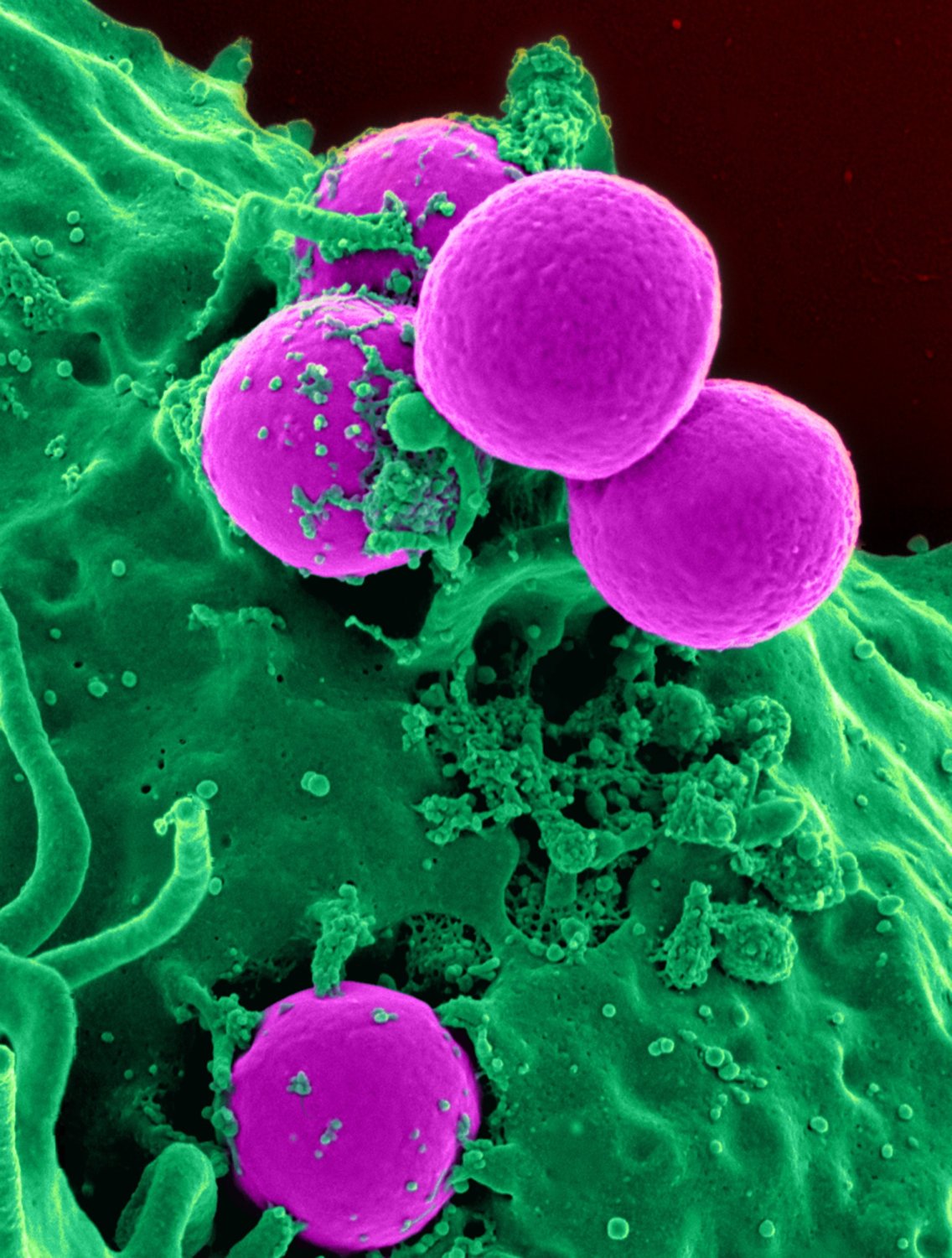don-t-miss-these-bacteria-breeding-spots-in-your-office